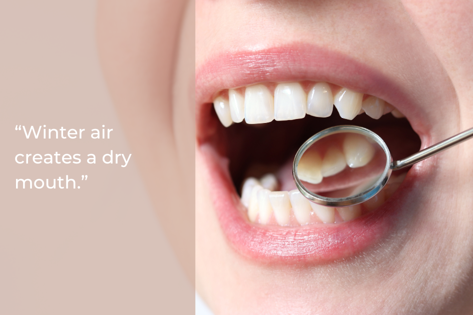 Close-up of an open mouth with a dental mirror, alongside text that reads, “Winter air creates a dry mouth.”.